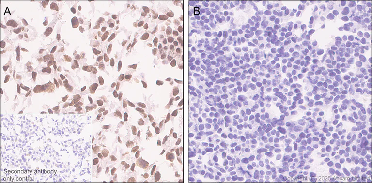 Immunohistochemistry (Formalin/PFA-fixed paraffin-embedded sections) - Anti-PAX3 antibody [EPR29741-157] - BSA and Azide free (AB326604)