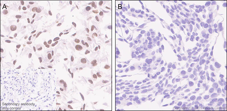 Immunohistochemistry (Formalin/PFA-fixed paraffin-embedded sections) - Anti-PAX3 antibody [EPR29741-157] - BSA and Azide free (AB326604)