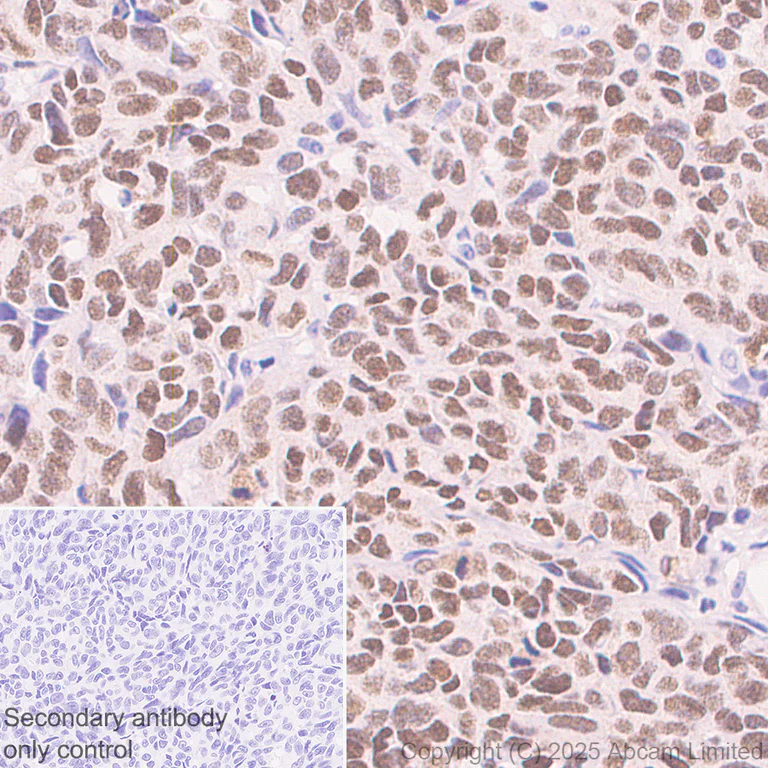 Immunohistochemistry (Formalin/PFA-fixed paraffin-embedded sections) - Anti-PAX3 antibody [EPR29741-157] - BSA and Azide free (AB326604)