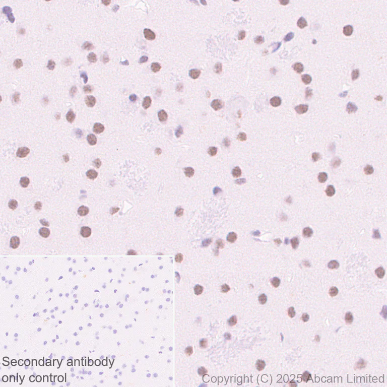 Immunohistochemistry (Formalin/PFA-fixed paraffin-embedded sections) - Anti-PAX3 antibody [EPR29741-157] - BSA and Azide free (AB326604)