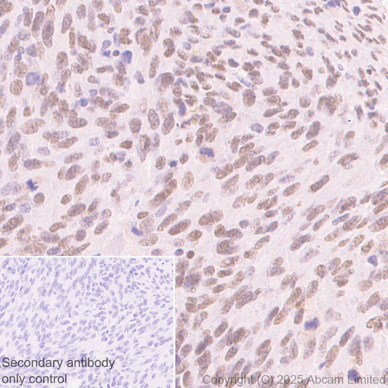Immunohistochemistry (Formalin/PFA-fixed paraffin-embedded sections) - Anti-PAX3 antibody [EPR29741-157] - BSA and Azide free (AB326604)