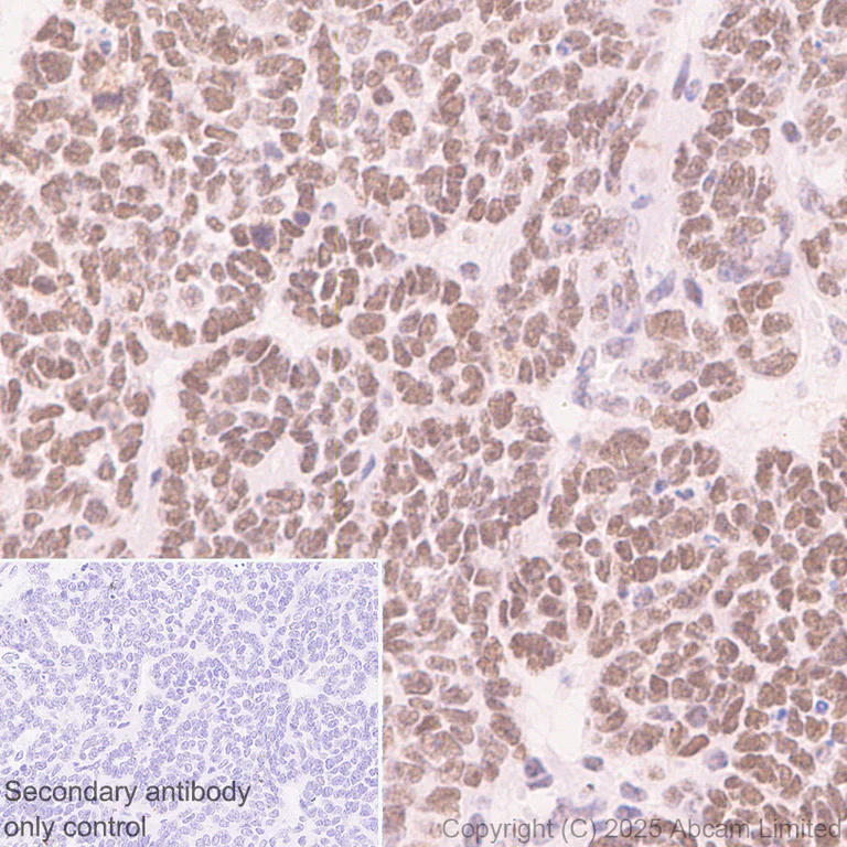 Immunohistochemistry (Formalin/PFA-fixed paraffin-embedded sections) - Anti-PAX3 antibody [EPR29741-157] - BSA and Azide free (AB326604)