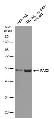 Western blot - Anti-PAX3 antibody [GT2411] -  BSA and Azide free (AB308424), expandable thumbnail