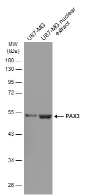 Western blot - Anti-PAX3 antibody [GT2411] - BSA and Azide free (AB308424)
