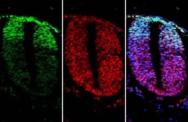 Immunohistochemistry (Formalin/PFA-fixed paraffin-embedded sections) - Anti-PAX3 antibody [HL160] (AB308330), expandable thumbnail