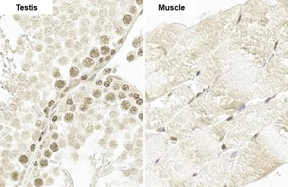 Immunohistochemistry paraffin embedded sections - Anti-PAX3 antibody [HL160] (AB308330), expandable thumbnail
