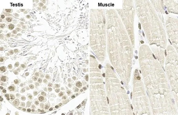 Immunohistochemistry paraffin embedded sections - Anti-PAX3 antibody [HL160] (AB308330), expandable thumbnail