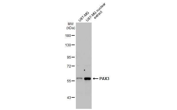 Western blot - Anti-PAX3 antibody [HL160] (AB308330), expandable thumbnail