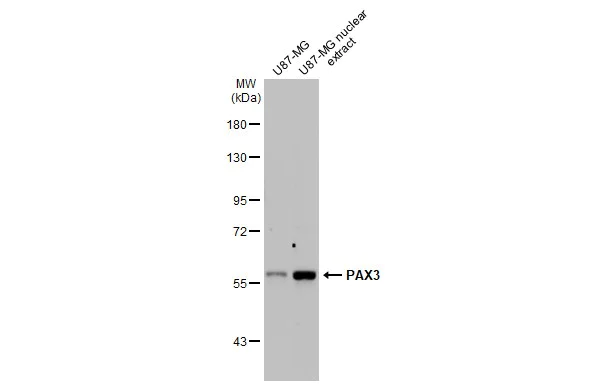 Western blot - Anti-PAX3 antibody [HL160] (AB308330)