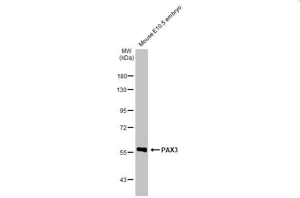 Western blot - Anti-PAX3 antibody [HL160] (AB308330), expandable thumbnail