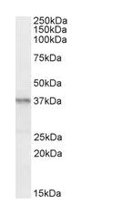 Western blot - Anti-PAX4 antibody (AB101721)