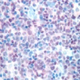 Immunohistochemistry (Formalin/PFA-fixed paraffin-embedded sections) - Anti-PAX5 antibody (AB15164)