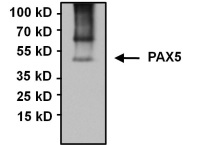 Immunoprecipitation - Anti-PAX5 antibody (AB183575), expandable thumbnail