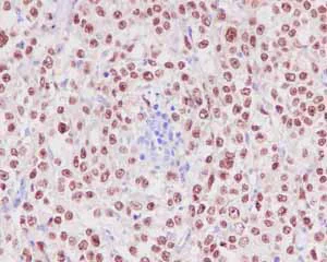 Immunohistochemistry (Formalin/PFA-fixed paraffin-embedded sections) - Anti-PAX5 antibody [EPR3730(2)] (AB109443)