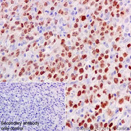 Immunohistochemistry (Formalin/PFA-fixed paraffin-embedded sections) - Anti-PAX5 antibody [EPR3730(2)] (AB109443)