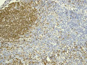 Immunohistochemistry (Formalin/PFA-fixed paraffin-embedded sections) - Anti-PAX5 antibody [EPR3730(2)] (AB109443)