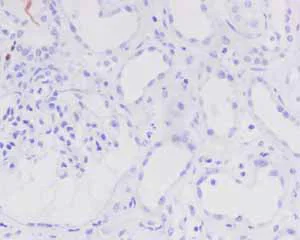 Immunohistochemistry (Formalin/PFA-fixed paraffin-embedded sections) - Anti-PAX5 antibody [EPR3730(2)] (AB109443)