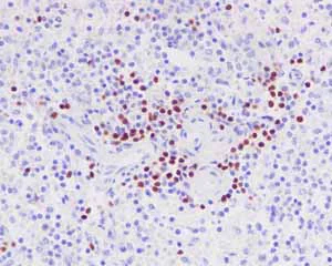 Immunohistochemistry (Formalin/PFA-fixed paraffin-embedded sections) - Anti-PAX5 antibody [EPR3730(2)] (AB109443)