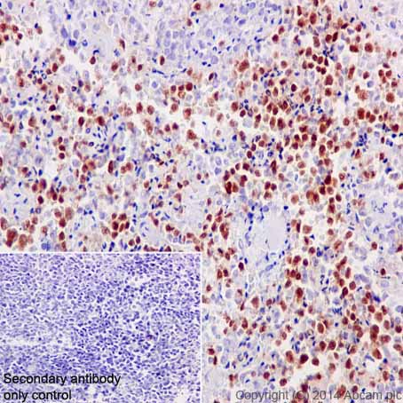 Immunohistochemistry (Formalin/PFA-fixed paraffin-embedded sections) - Anti-PAX5 antibody [EPR3730(2)] - BSA and Azide free (ab193556), expandable thumbnail