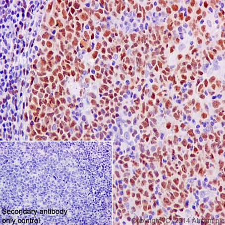 Immunohistochemistry (Formalin/PFA-fixed paraffin-embedded sections) - Anti-PAX5 antibody [EPR3730(2)] - BSA and Azide free (AB193556), expandable thumbnail