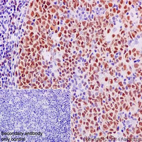 Immunohistochemistry (Formalin/PFA-fixed paraffin-embedded sections) - Anti-PAX5 antibody [EPR3730(2)] - BSA and Azide free (AB193556)