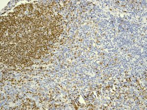 Immunohistochemistry (Formalin/PFA-fixed paraffin-embedded sections) - Anti-PAX5 antibody [EPR3730(2)] - BSA and Azide free (ab193556), expandable thumbnail