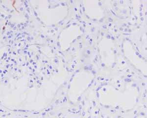 Immunohistochemistry (Formalin/PFA-fixed paraffin-embedded sections) - Anti-PAX5 antibody [EPR3730(2)] - BSA and Azide free (ab193556), expandable thumbnail