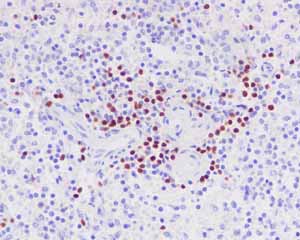 Immunohistochemistry (Formalin/PFA-fixed paraffin-embedded sections) - Anti-PAX5 antibody [EPR3730(2)] - BSA and Azide free (ab193556), expandable thumbnail