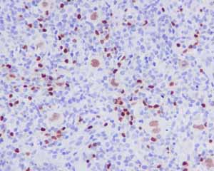 Immunohistochemistry (Formalin/PFA-fixed paraffin-embedded sections) - Anti-PAX5 antibody [EPR3730(2)] - BSA and Azide free (ab193556), expandable thumbnail