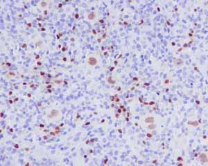 Immunohistochemistry (Formalin/PFA-fixed paraffin-embedded sections) - Anti-PAX5 antibody [EPR3730(2)] - BSA and Azide free (AB193556)