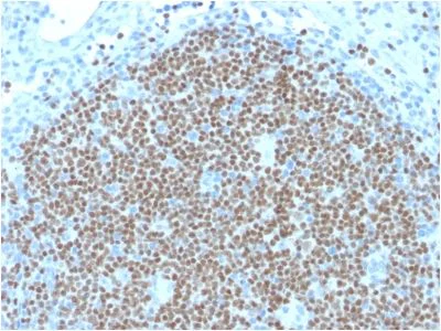 Immunohistochemistry (Formalin/PFA-fixed paraffin-embedded sections) - Anti-PAX5 antibody [PAX5/2595] (AB238031)