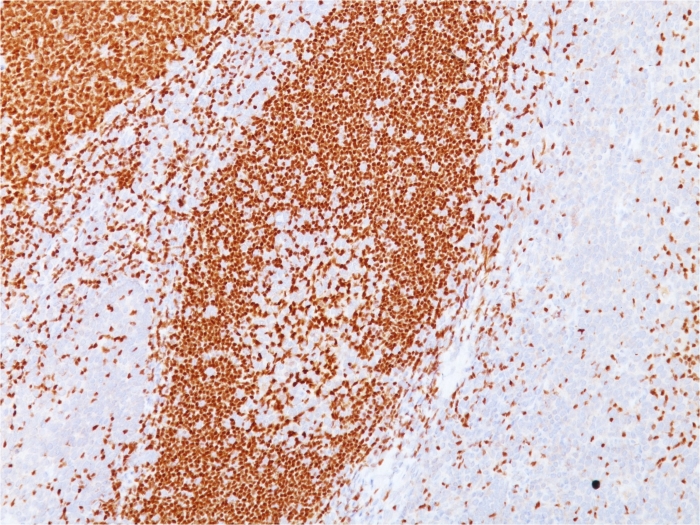 Immunohistochemistry (Formalin/PFA-fixed paraffin-embedded sections) - Anti-PAX5 antibody [PAX5/3735] - BSA and Azide free (AB268218), expandable thumbnail