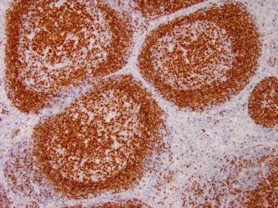Immunohistochemistry (Formalin/PFA-fixed paraffin-embedded sections) - Anti-PAX5 antibody [PAX5/3735] - BSA and Azide free (AB268218)