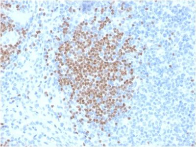 Immunohistochemistry (Formalin/PFA-fixed paraffin-embedded sections) - Anti-PAX5 antibody [PCRP-PAX5-1B1] (AB238030)
