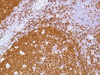 Immunohistochemistry (Formalin/PFA-fixed paraffin-embedded sections) - Anti-PAX5 antibody [SP34] - BSA and Azide free (AB237773)
