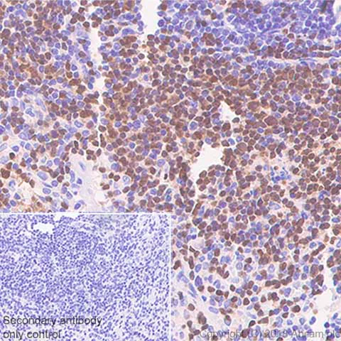 Immunohistochemistry (Formalin/PFA-fixed paraffin-embedded sections) - Anti-PAX5 antibody [SP34] - ChIP Grade (AB227635)