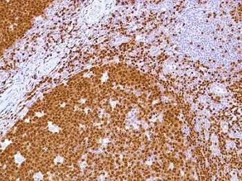 Immunohistochemistry (Formalin/PFA-fixed paraffin-embedded sections) - Anti-PAX5 antibody [SP34] - ChIP Grade (AB227635)