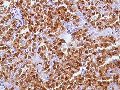 Immunohistochemistry (Formalin/PFA-fixed paraffin-embedded sections) - Anti-PAX5 antibody [SP34] - ChIP Grade (AB227635)