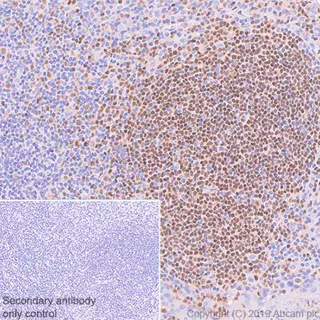 Immunohistochemistry (Formalin/PFA-fixed paraffin-embedded sections) - Anti-PAX5 antibody [SP34] - ChIP Grade (AB227635)