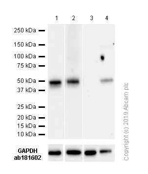 Western blot - Anti-PAX5 antibody [SP34] - ChIP Grade (AB227635)