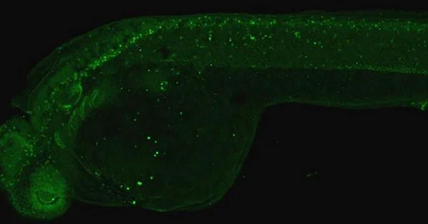 IHC - Wholemount - Anti-PAX6 antibody (AB209836)
