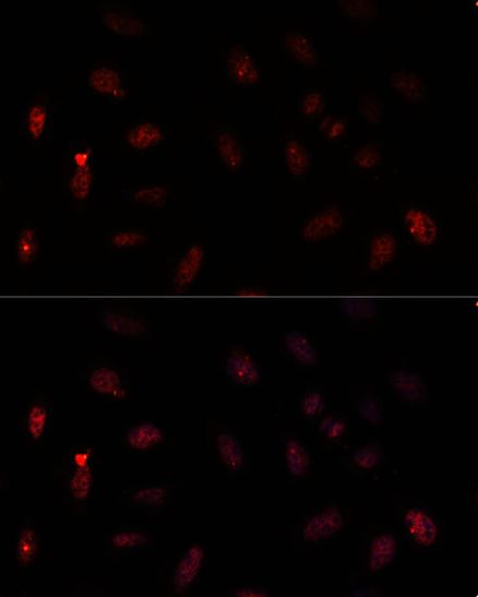 Immunocytochemistry/ Immunofluorescence - Anti-PAX6 antibody (AB238527)