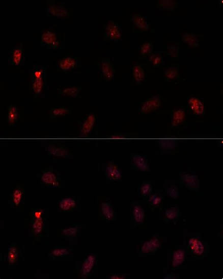 Immunocytochemistry/ Immunofluorescence - Anti-PAX6 antibody (AB238527)
