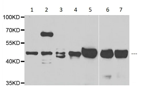 Western blot - Anti-PAX6 antibody (AB238527)