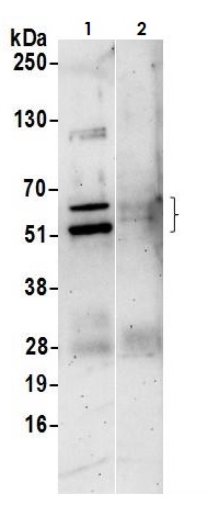 Immunoprecipitation - Anti-PAX6 antibody (AB265608)