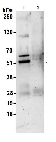 Immunoprecipitation - Anti-PAX6 antibody (AB265608)