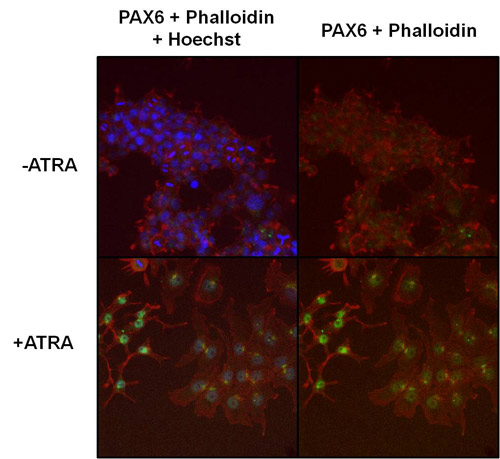 Immunocytochemistry/ Immunofluorescence - Anti-PAX6 antibody (AB5790), expandable thumbnail