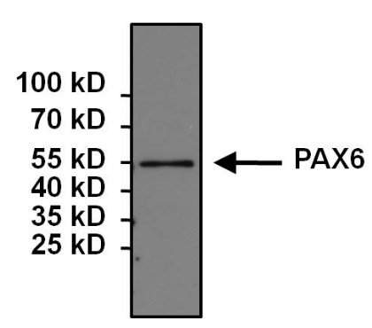 Immunoprecipitation - Anti-PAX6 antibody (AB5790), expandable thumbnail
