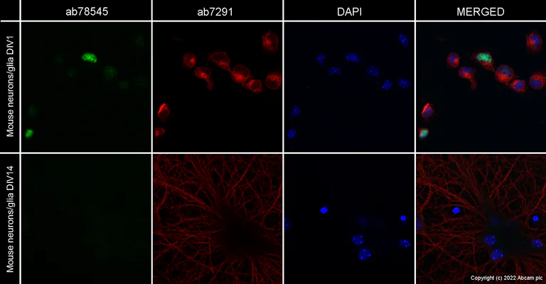 Immunocytochemistry/ Immunofluorescence - Anti-PAX6 antibody [AD2.38] (AB78545)