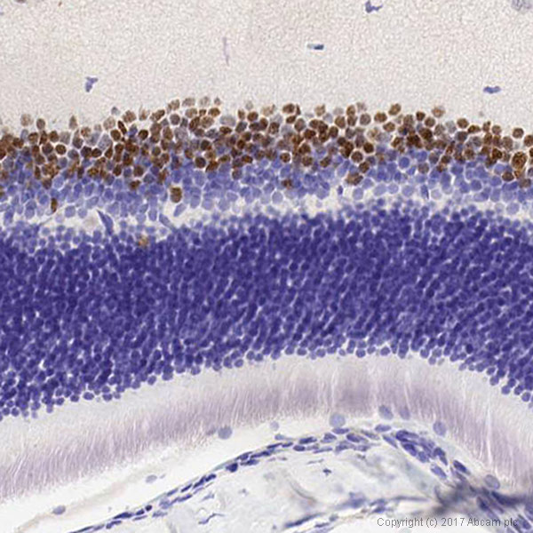 Immunohistochemistry (Formalin/PFA-fixed paraffin-embedded sections) - Anti-PAX6 antibody [AD2.38] (AB78545), expandable thumbnail